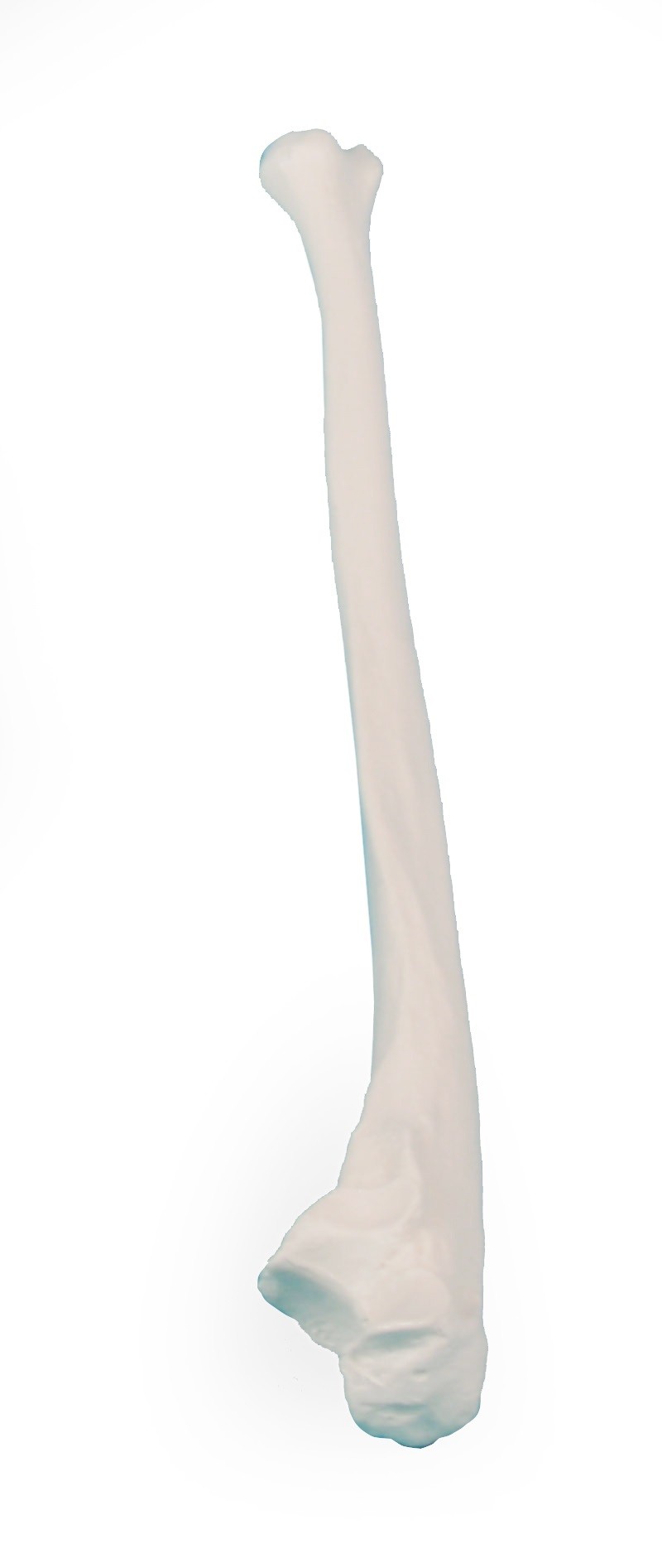 Kość łokciowa - Image no.: 1