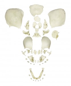 Rozczłonkowana ludzka czaszka płodu, w pełni rozwinięta - Image no.: 1