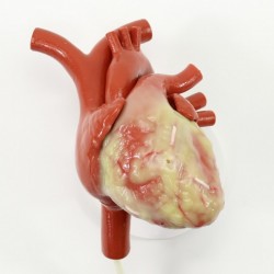 Chirurgiczny model bijącego serca do wszczepiania bypassów (CABG) - Image no.: 1