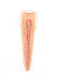 Kompleksowy model dolnej szczęki (lewa połowa) z chorymi zębami, nerwami, naczyniami i gruczołami, 19 części - Image no.: 4