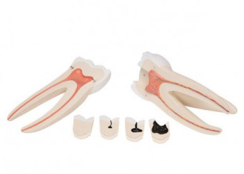 Model ludzkiego zęba, 15 razy powiększony, 6 części - Image no.: 3