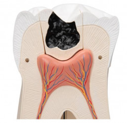 Model ludzkiego zęba, 15 razy powiększony, 6 części - Image no.: 4