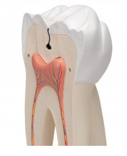 Model ludzkiego zęba, 15 razy powiększony, 6 części - Image no.: 5