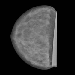 Fantom piersi do mammografii i tomosyntezy - Image no.: 3