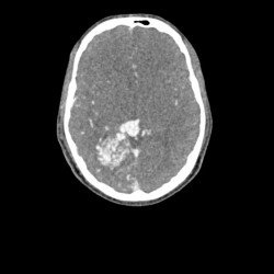 Fantom głowy i szyi do tomografii komputerowej, RTG i radioterapii - Image no.: 2