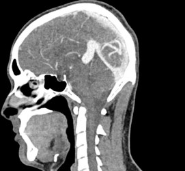 Fantom głowy i szyi do tomografii komputerowej, RTG i radioterapii - Image no.: 4