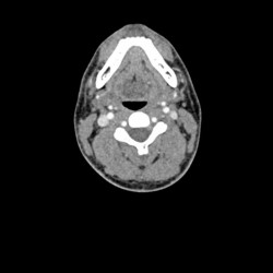 Fantom głowy i szyi do tomografii komputerowej, RTG i radioterapii - Image no.: 5