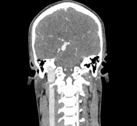Fantom głowy i szyi do tomografii komputerowej, RTG i radioterapii - Image no.: 7