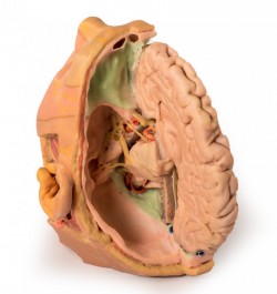 Wydruk anatomiczny 3D - głowa i szyja, przekrój strzałkowy - Image no.: 4