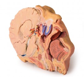 Wydruk anatomiczny 3D - głowa i szyja, przekrój strzałkowy - Image no.: 5