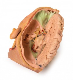 Wydruk anatomiczny 3D - głowa i szyja, przekrój strzałkowy - Image no.: 6