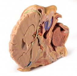 Wydruk anatomiczny 3D - głowa i szyja, przekrój strzałkowy - Image no.: 7