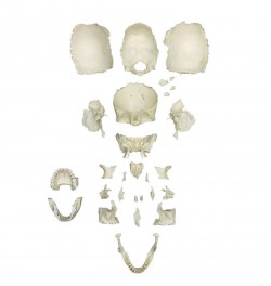 Model czaszki osoby dorosłej - kości rozmontowane w walizce - Image no.: 2