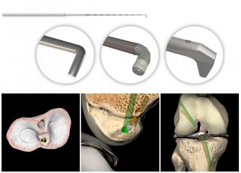ArthroS™ - symulator wysokiej wierności do nauki artroskopii stawu kolanowego - Image no.: 4