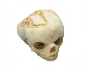 Model czaszki płodu, 17 tygodni - Image no.: 1