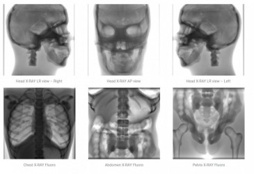 Fantom radiologiczny osoby dorosłej do RTG, CT i MRI - Image no.: 4