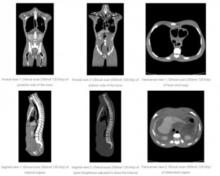 Fantom radiologiczny osoby dorosłej do RTG, CT i MRI - Image no.: 5