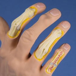 Model choroby zwyrodnieniowej stawów dłoni - Image no.: 2