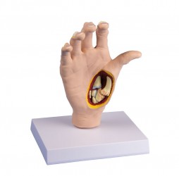 Model choroby zwyrodnieniowej stawów dłoni - Image no.: 1