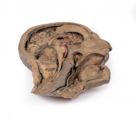 Model anatomiczny strzałkowego przekroju głowy i szyi - Image no.: 1