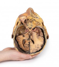 Model anatomiczny poprzecznego przekroju głowy - Image no.: 7