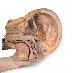 Model anatomiczny strzałkowego przekroju głowy i szyi (dół podskroniowy+ tętnica szyjna) - Image no.: 2