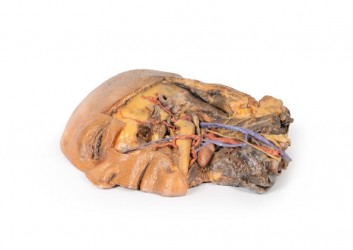 Model anatomiczny strzałkowego przekroju głowy i szyi (dół podskroniowy+ tętnica szyjna) - Image no.: 4