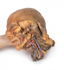 Model anatomiczny strzałkowego przekroju głowy i szyi (dół podskroniowy+ tętnica szyjna) - Image no.: 7