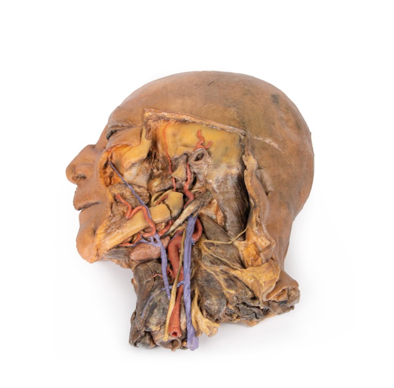 Model anatomiczny strzałkowego przekroju głowy i szyi (dół podskroniowy+ tętnica szyjna) - Image no.: 1