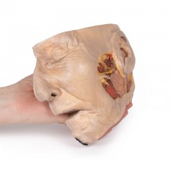 Model anatomiczny ślinianki przyusznej i nerwu twarzowego - Image no.: 3