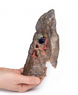 Model anatomiczny wnęki lewego płuca - Image no.: 3