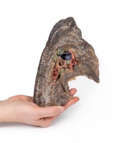 Model anatomiczny wnęki lewego płuca - Image no.: 4