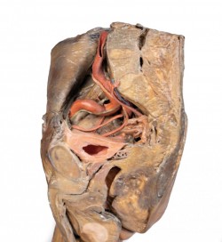 Model anatomiczny wnęki lewego płuca - Image no.: 5