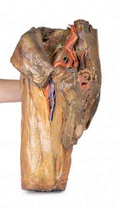 Model anatomiczny wnęki lewego płuca - Image no.: 7