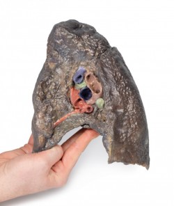 Model anatomiczny wnęki prawego płuca - Image no.: 3