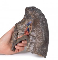 Model anatomiczny wnęki prawego płuca - Image no.: 4