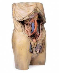 Model anatomiczny jamy brzusznej z obustronną przepukliną - Image no.: 4