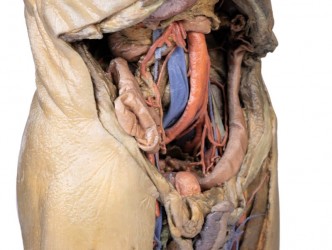 Model anatomiczny jamy brzusznej z obustronną przepukliną - Image no.: 5