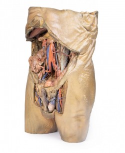 Model anatomiczny jamy brzusznej z obustronną przepukliną - Image no.: 6