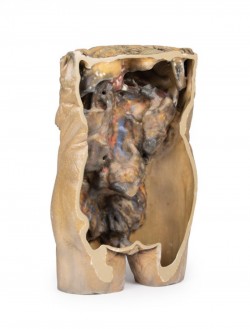 Model anatomiczny jamy brzusznej z obustronną przepukliną - Image no.: 7