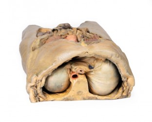 Model anatomiczny jamy brzusznej z obustronną przepukliną - Image no.: 8