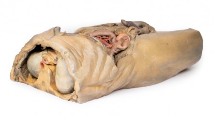 Model anatomiczny jamy brzusznej z obustronną przepukliną - Image no.: 9