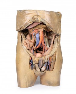 Model anatomiczny jamy brzusznej z obustronną przepukliną - Image no.: 1