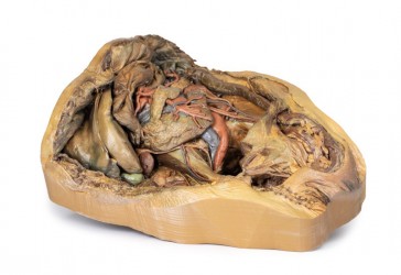 Model anatomiczny jamy brzusznej- przepuklina pachwinowa - Image no.: 3