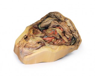 Model anatomiczny jamy brzusznej- przepuklina pachwinowa - Image no.: 4