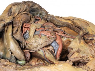 Model anatomiczny jamy brzusznej- przepuklina pachwinowa - Image no.: 5