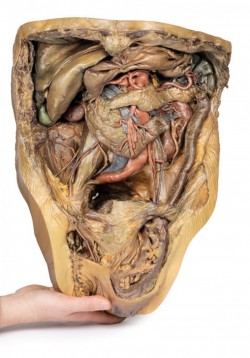 Model anatomiczny jamy brzusznej- przepuklina pachwinowa - Image no.: 7