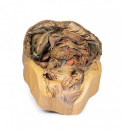 Model anatomiczny jamy brzusznej- przepuklina pachwinowa - Image no.: 1