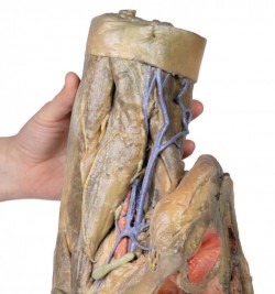 Model anatomiczny żeńskiej miednicy i uda - Image no.: 8