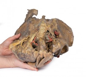 Model anatomiczny miednicy żeńskiej (struktury głębokie) - Image no.: 4